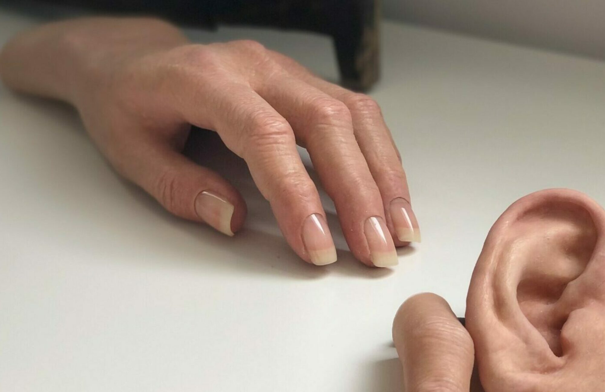 prothèse esthétiques AHP Europe main face